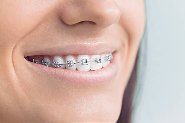 Best Teeth Whitening  in Seguin, TX